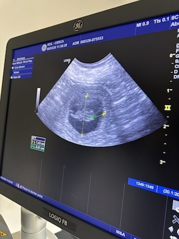 La Gestation de Pritika est confirmée